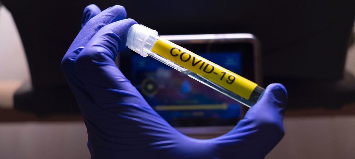 Coronavirus : Un vaccin disponible seulement vers la fin de 2021
