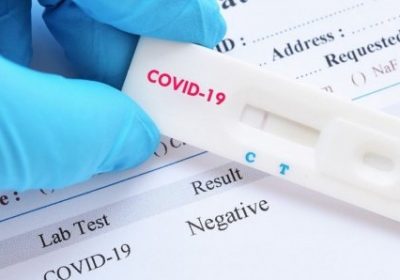 Covid-19 : les Tests de diagnostic rapide mis sur le marché, à compter de ce samedi 31 juillet 2021