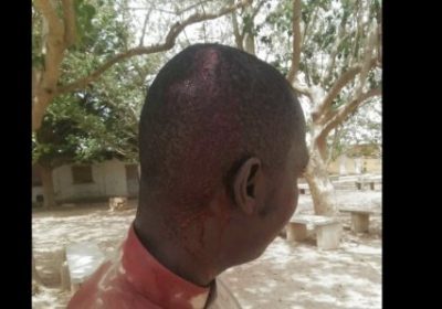 Lycée de Sangué : Le surveillant raconte son agression par un élève