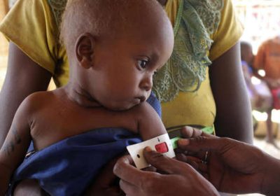 Madagascar: une approche novatrice pour soigner les enfants malnutris