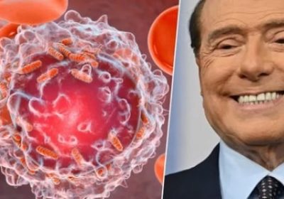 “Même les personnes qui mènent une vie très saine peuvent la développer”: ce qu’il faut savoir sur la leucémie, dont souffre Silvio Berlusconi