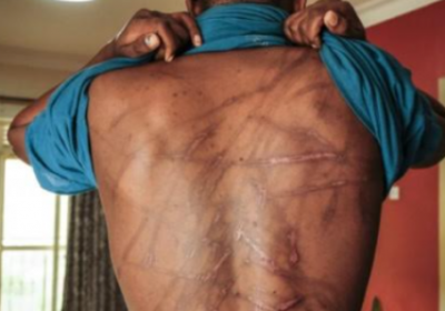 Détenu torturé à Ziguinchor: Le surveillant pénitentiaire M.D déféré au parquet
